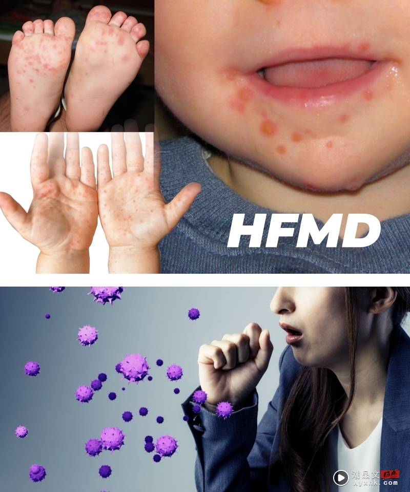 相关信息 | 除了感冒、Covid...马来西亚儿童得小心这6种传染病！还会传染给大人！ 更多热点 图2张